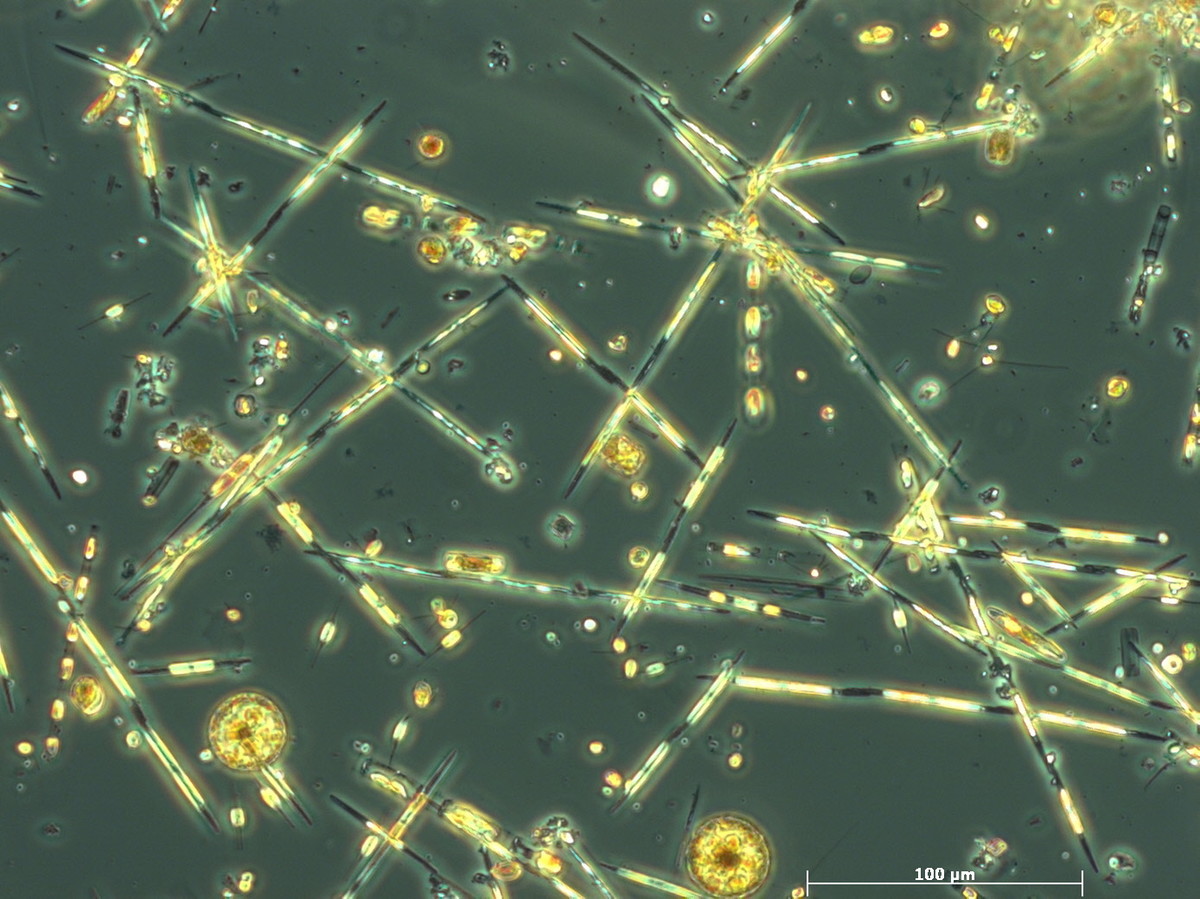 Toxic Phytoplankton HAB